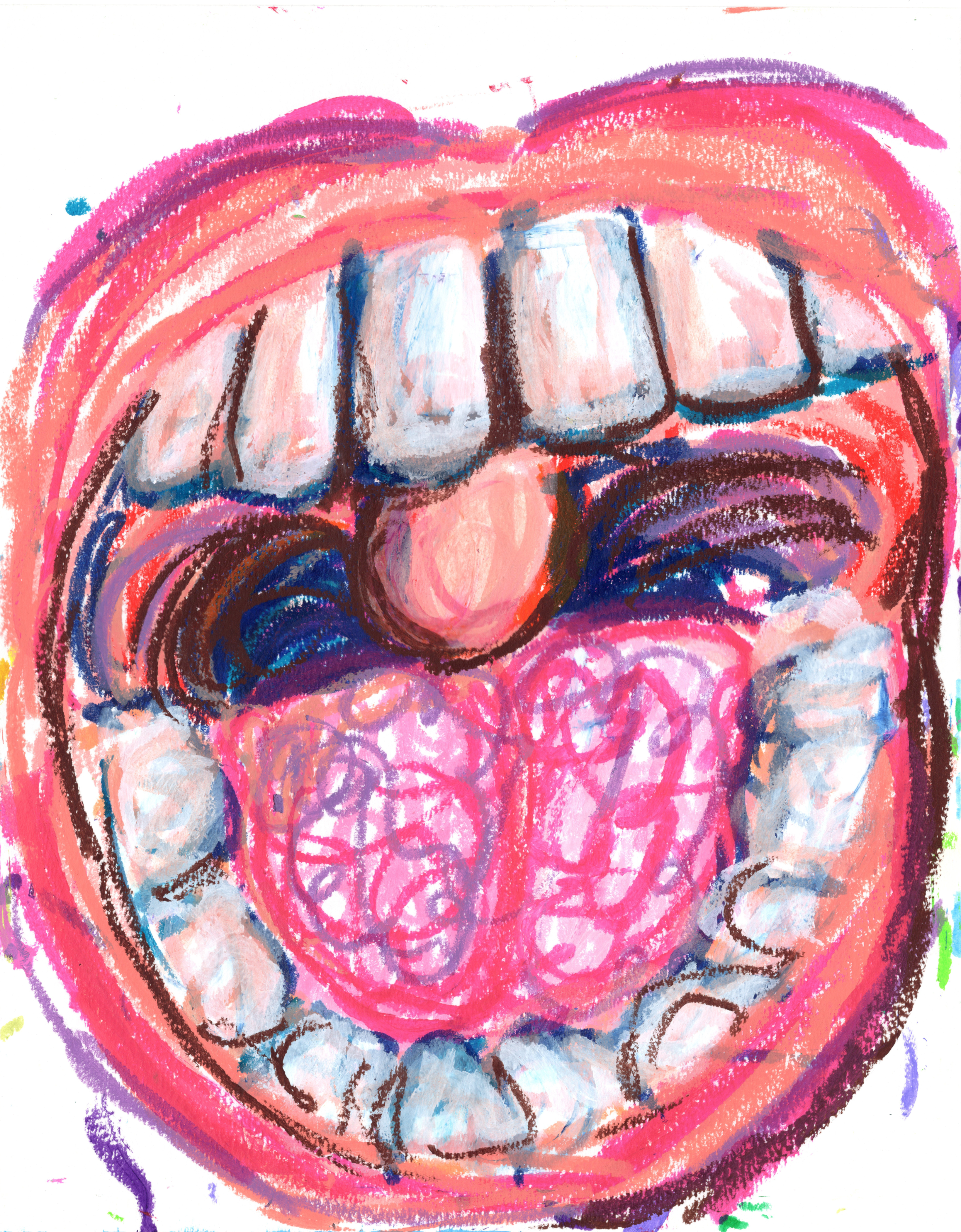 Open Wide 300.jpg500